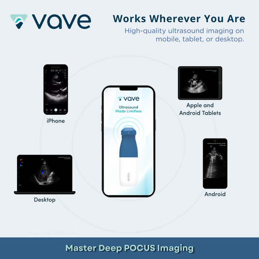 Vave Phase Probe - Wireless Ultrasound