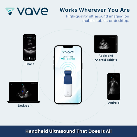 Vave Universal Probe - Wireless Ultrasound