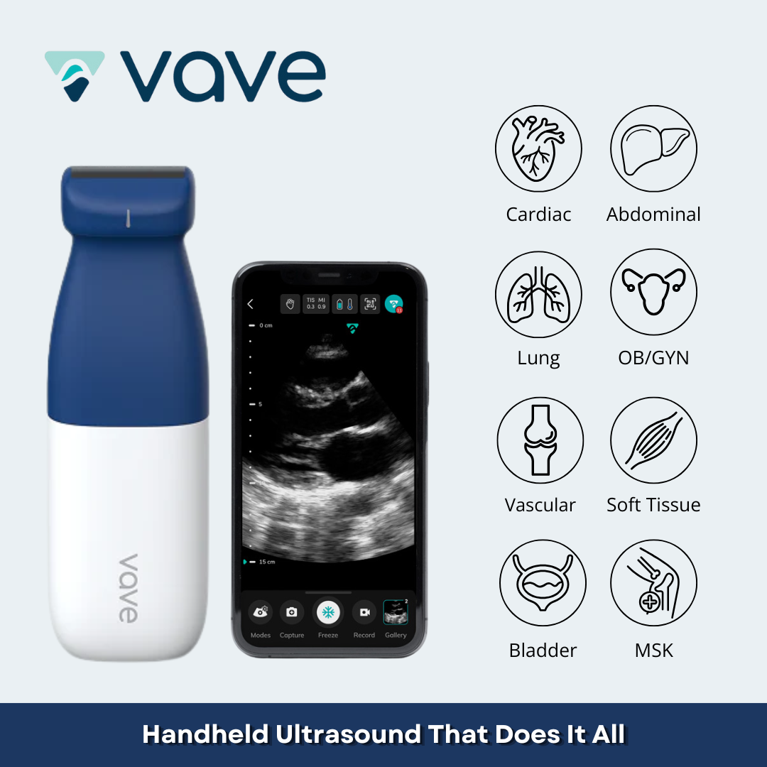 Vave Universal Probe - Wireless Ultrasound