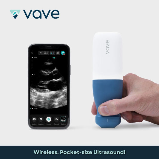 Vave Portable Ultrasound