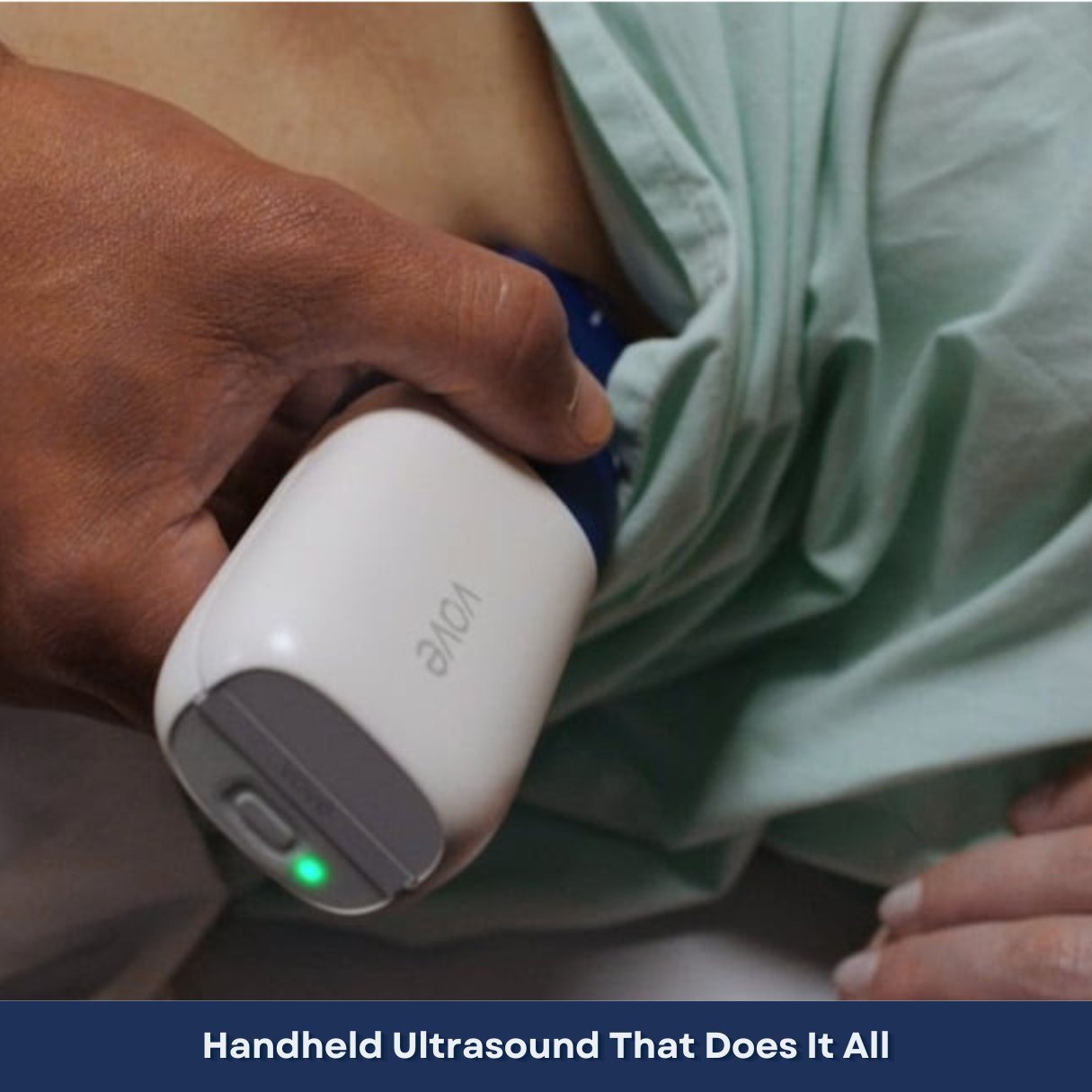Vave Universal Probe - Wireless Ultrasound