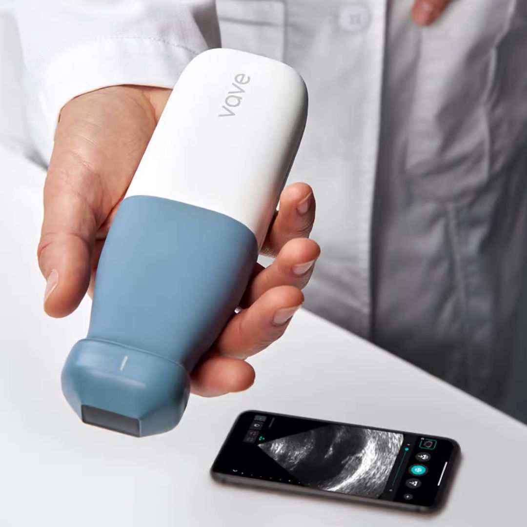 Vave Portable Ultrasound